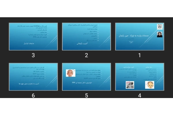 پاورپوینت صدمات وارده به نوزاد حین زایمان