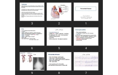 پاورپوینت Pericardial Disease