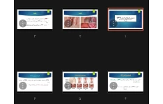 جزوه ویروس پاپیلومای انسان HPV