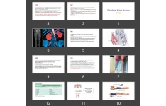 پاورپوینت Peripheral Artery Disease PAD