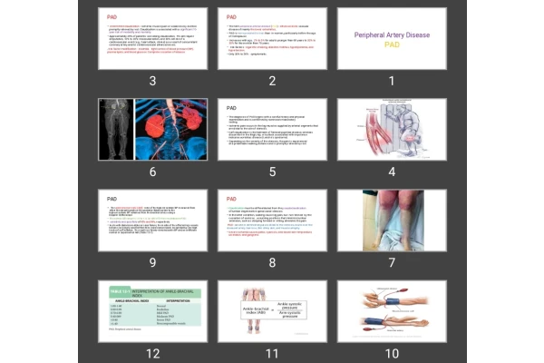 پاورپوینت Peripheral Artery Disease PAD