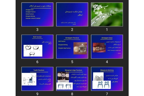 پاورپوینت عوامل شکست ترمیم های آمالگام
