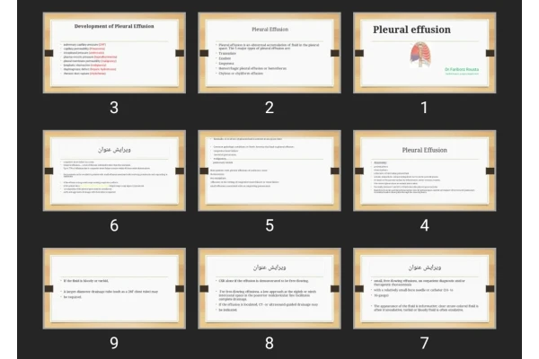 پاورپوینت Pleural effusion