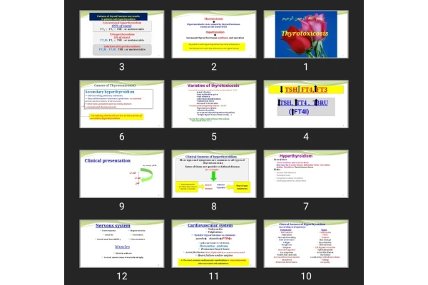 پاورپوینت Thyrotoxicosis