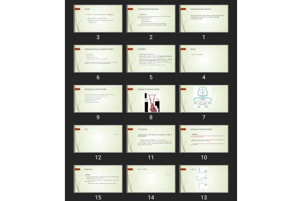 پاورپوینت Cerebrovascular Diseases