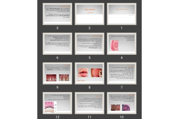 پاورپوینت مخاط دهان