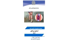 پمفلت ترومیوز ورید عمقی DVT