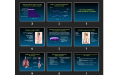 پاورپوینت Gastroesophageal Reflux Disease and Barrett’s Esophagus