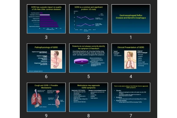 پاورپوینت Gastroesophageal Reflux Disease and Barrett’s Esophagus
