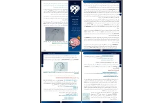 جزوه سکته مغزی