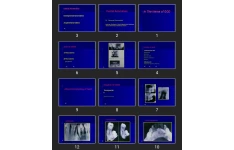 پاورپوینت Dental Anomalies
