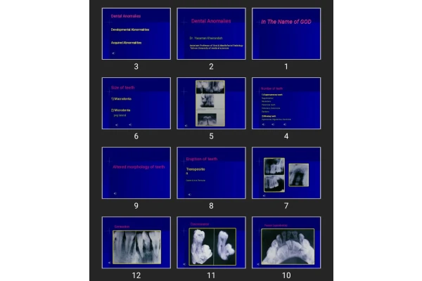 پاورپوینت Dental Anomalies