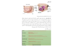 جزوه بیماری های غدد بزاقی