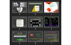 پاورپوینت Intraoral principles and errors