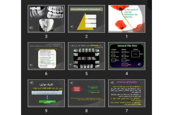 پاورپوینت Intraoral principles and errors