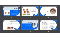 پاورپوینت کاتاراکت