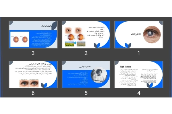 پاورپوینت کاتاراکت