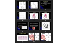 پاورپوینت Fast & Easy ECG