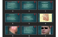 پاورپوینت SALIVARY GLANDS