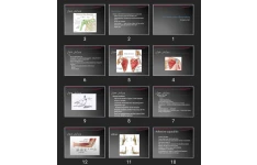 پاورپوینت Periarticular disorders