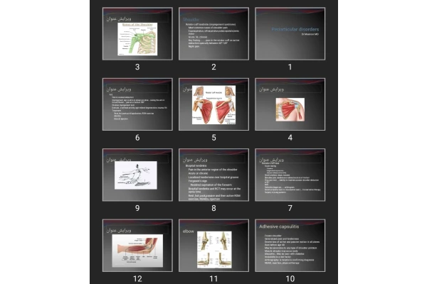 پاورپوینت Periarticular disorders