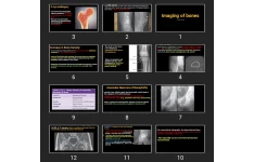 پاورپوینت Imaging of bones