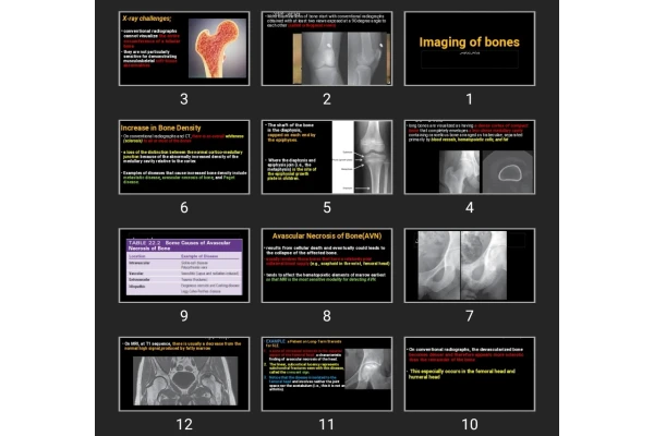پاورپوینت Imaging of bones