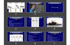 پاورپوینت Hip Disorders