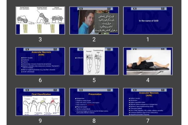 پاورپوینت Hip Disorders
