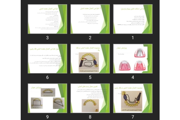 پاورپوینت مراحل طراحی اسکلت فلزی پروتز پارسیل