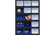 پاورپوینت Disorders of pancreas