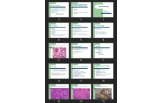 پاورپوینت The endocrine system