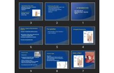 پاورپوینت Restoration of Endodontically treated Teeth