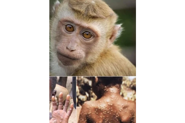 تحقیق در مورد ویروس آبله میمون