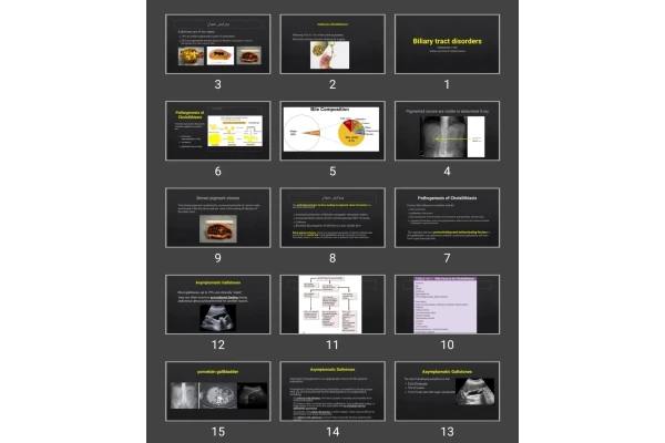 پاورپوینت Biliary tract disorders