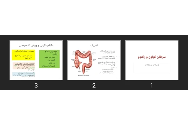 پاورپوینت سرطان کولون و رکتوم