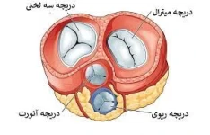   پاورپوینت اختلالات دریچه های قلبی