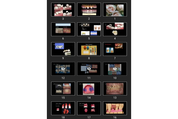 پاورپوینت PRINCIPLES OF TOOTH PREPARATION