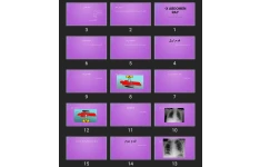 پاورپوینت Abdomen x-ray