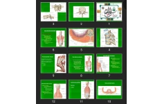 پاورپوینت Chest wall muscles - Diaphragm