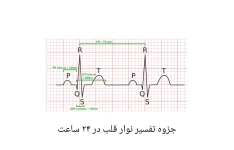 جزوه کامل آموزش نوار قلب در ۲۴ ساعت