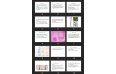 پاورپوینت Amyloidosis, immunodeficincy and HIV