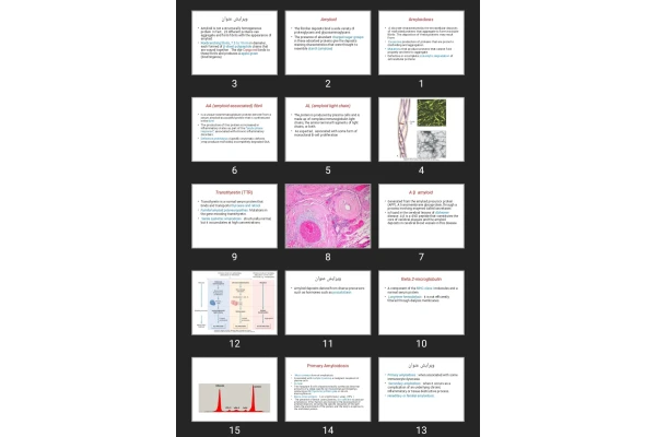 پاورپوینت Amyloidosis, immunodeficincy and HIV