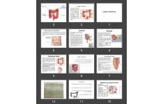 پاورپوینت روده بزرگ Large intestine