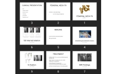 پاورپوینت FEMORAL NECK FX