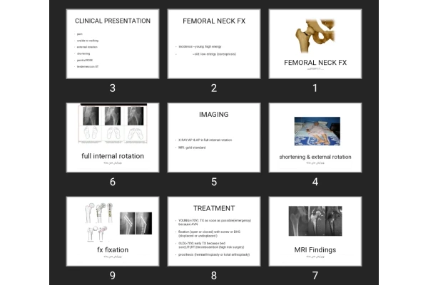 پاورپوینت FEMORAL NECK FX