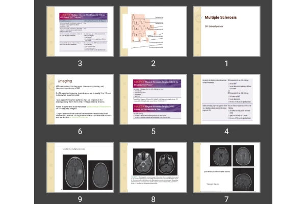 پاورپوینت  Multiple Sclerosis MS