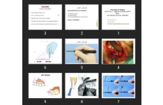 پاورپوینت Principles of Surgery