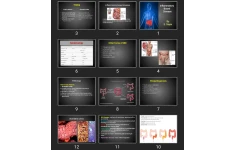 پاورپوینت Inflammatory Bowel Disease