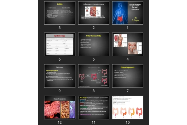 پاورپوینت Inflammatory Bowel Disease